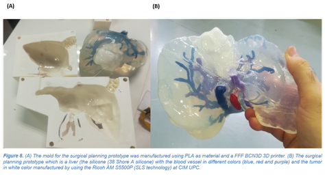 Nuevo artículo publicado: "3D Printing in Medicine for Preoperative Surgical Planning: A Review"